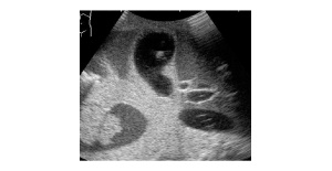 03-fantoma-de-ecografia-abdominal-con-patologias-abdfan-us-1b-de-kyoto-kagaku