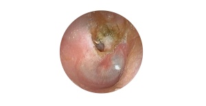 Simulador de examen de oído EAR II MW12 de Kyoto Kagaku