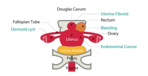 Fantoma de ultrasonido pélvico femenino US-10, US-10A, US-10B, US-10C, US-10D de Kyoto Kagaku