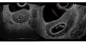 Fantoma de ultrasonido pélvico femenino US-10, US-10A, US-10B, US-10C, US-10D de Kyoto Kagaku