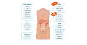 05-simulador-de-exploracion-abdominal-abdoabby-mw43-de-kyoto-kagaku