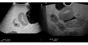 Fantoma de ultrasonido pélvico femenino US-10, US-10A, US-10B, US-10C, US-10D de Kyoto Kagaku