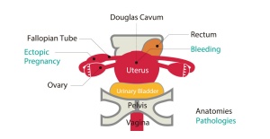Fantoma de ultrasonido pélvico femenino US-10, US-10A, US-10B, US-10C, US-10D de Kyoto Kagaku