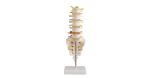 vertebras-lumbares-hernia-discal-xc-119-human3d