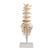 vertebras-lumbares-hernia-discal-xc-119-human3d