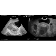 Fantoma de ultrasonido pélvico femenino US-10, US-10A, US-10B, US-10C, US-10D de Kyoto Kagaku