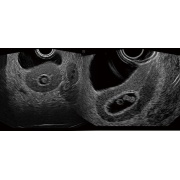 Fantoma de ultrasonido pélvico femenino US-10, US-10A, US-10B, US-10C, US-10D de Kyoto Kagaku