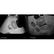Fantoma de ultrasonido pélvico femenino US-10, US-10A, US-10B, US-10C, US-10D de Kyoto Kagaku