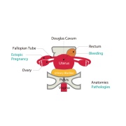 Fantoma de ultrasonido pélvico femenino US-10, US-10A, US-10B, US-10C, US-10D de Kyoto Kagaku